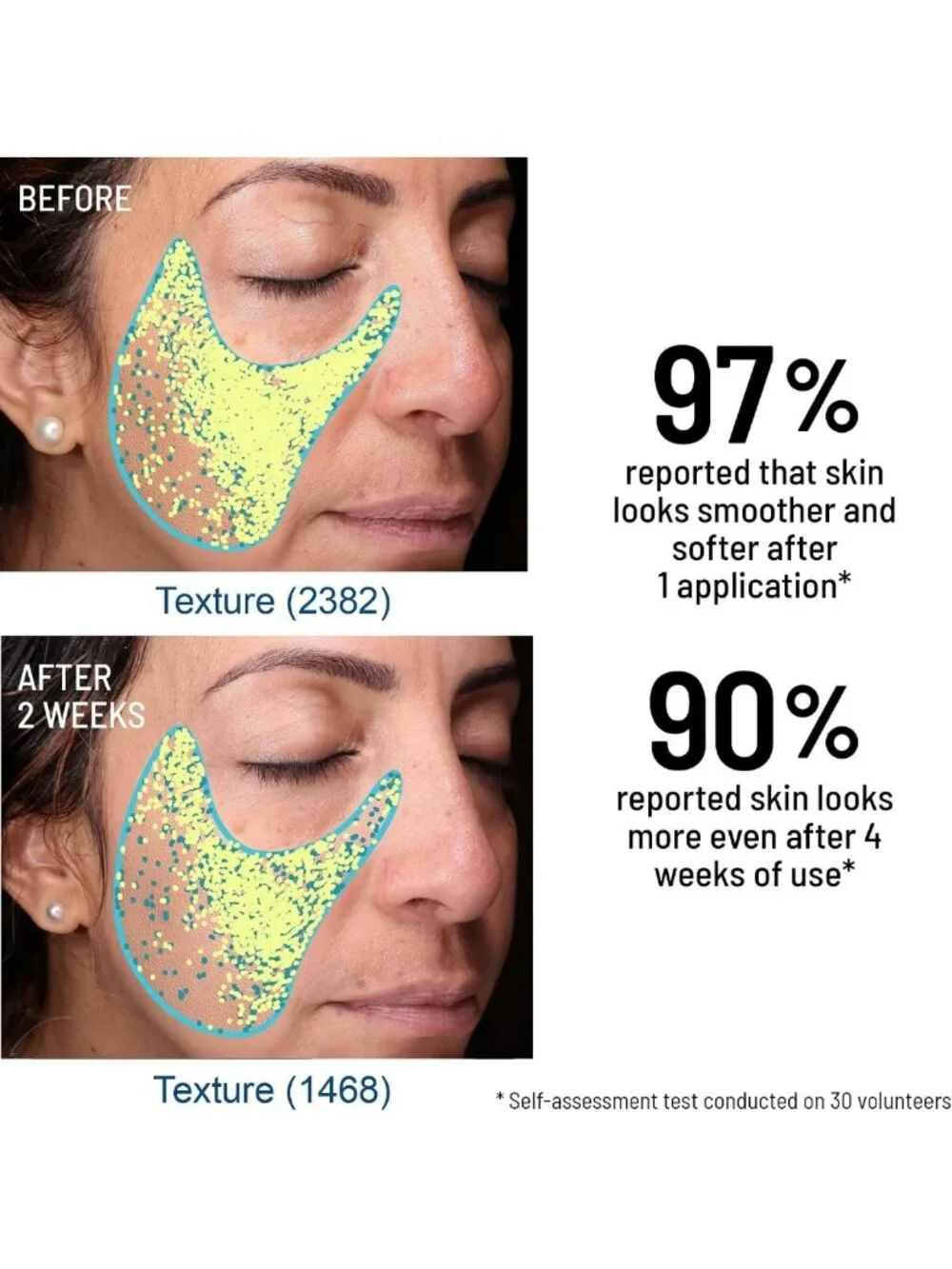 Travel Size Microdermabrasion Exfoliator - Refines Texture, Reduces Fine Lines